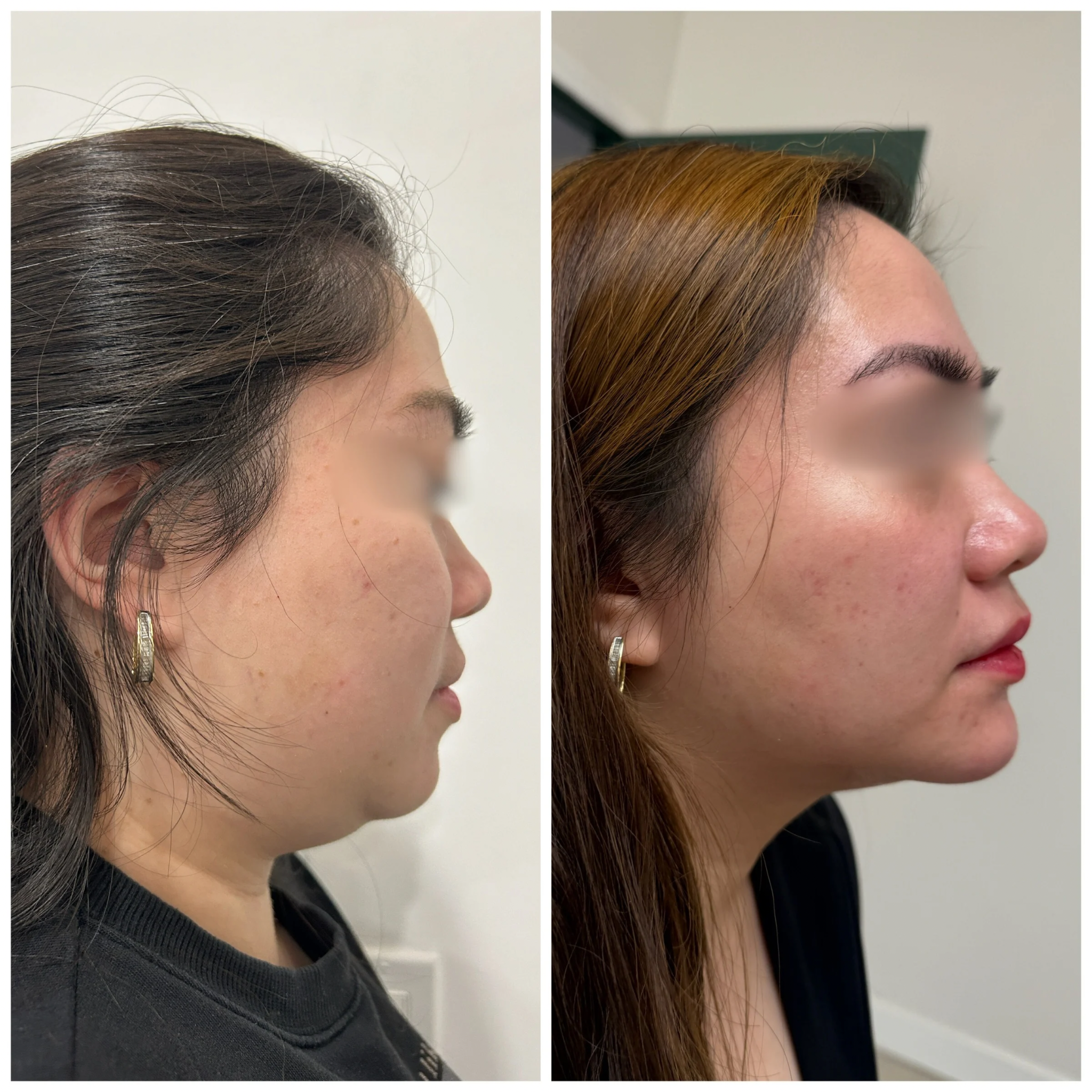 Multi-modality Approach